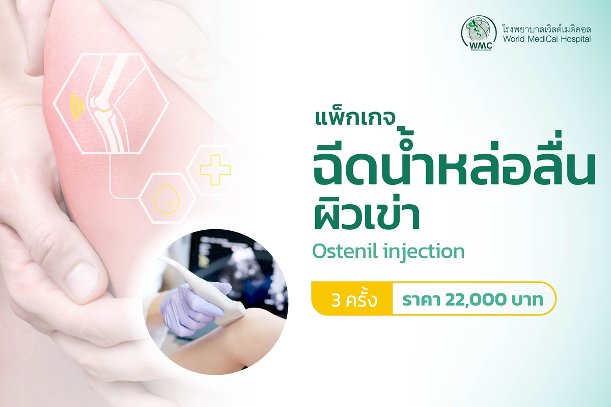 แพ็กเกจ ฉีดน้ำหล่อลื่นผิวข้อเข่า Ostenil injection