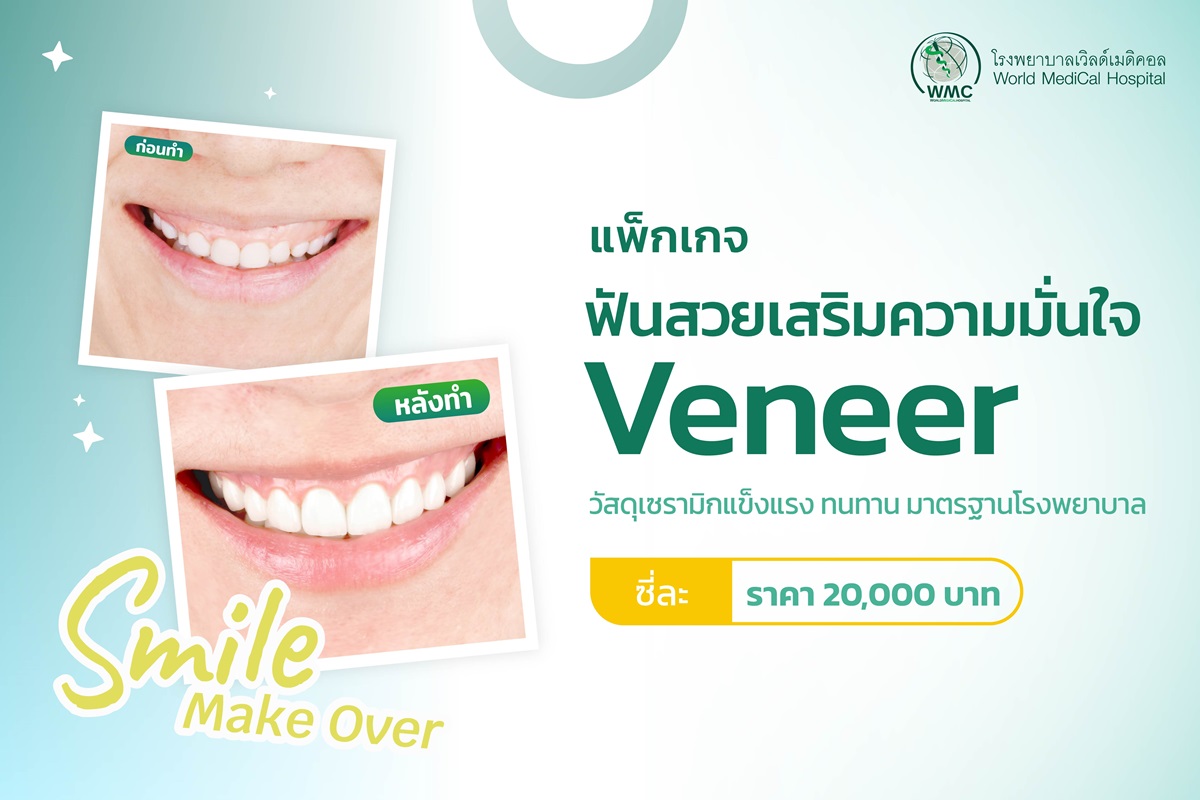 แพ็กเกจ Smile Make Over (Veneer)