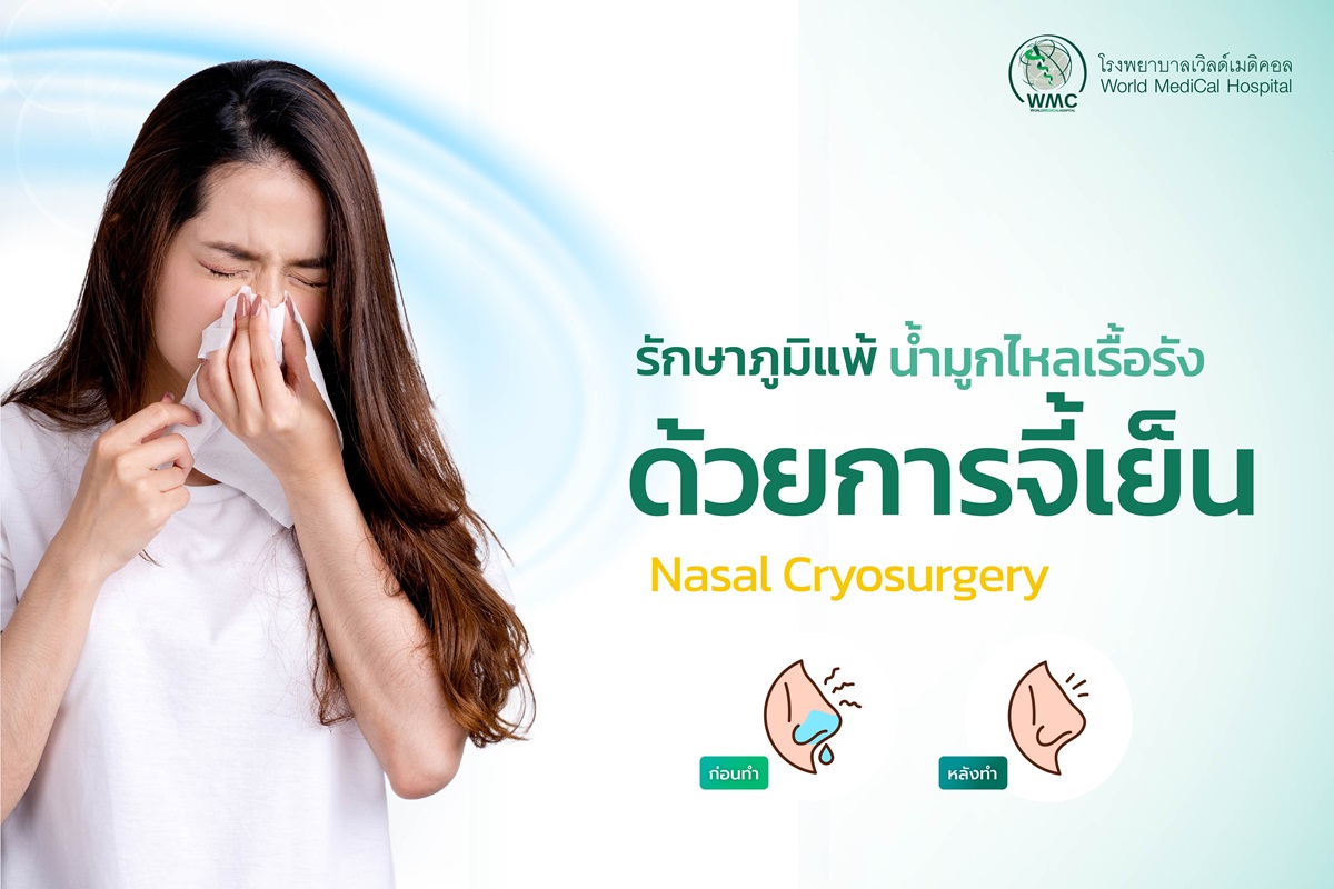 รักษาภูมิแพ้ น้ำมูกไหลเรื้อรัง ด้วยการจี้เย็น (Nasal Cryosurgery)