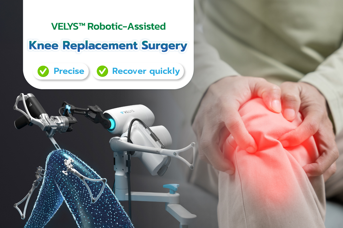 VELYS™ Robotic-Assisted Knee Replacement Surgery