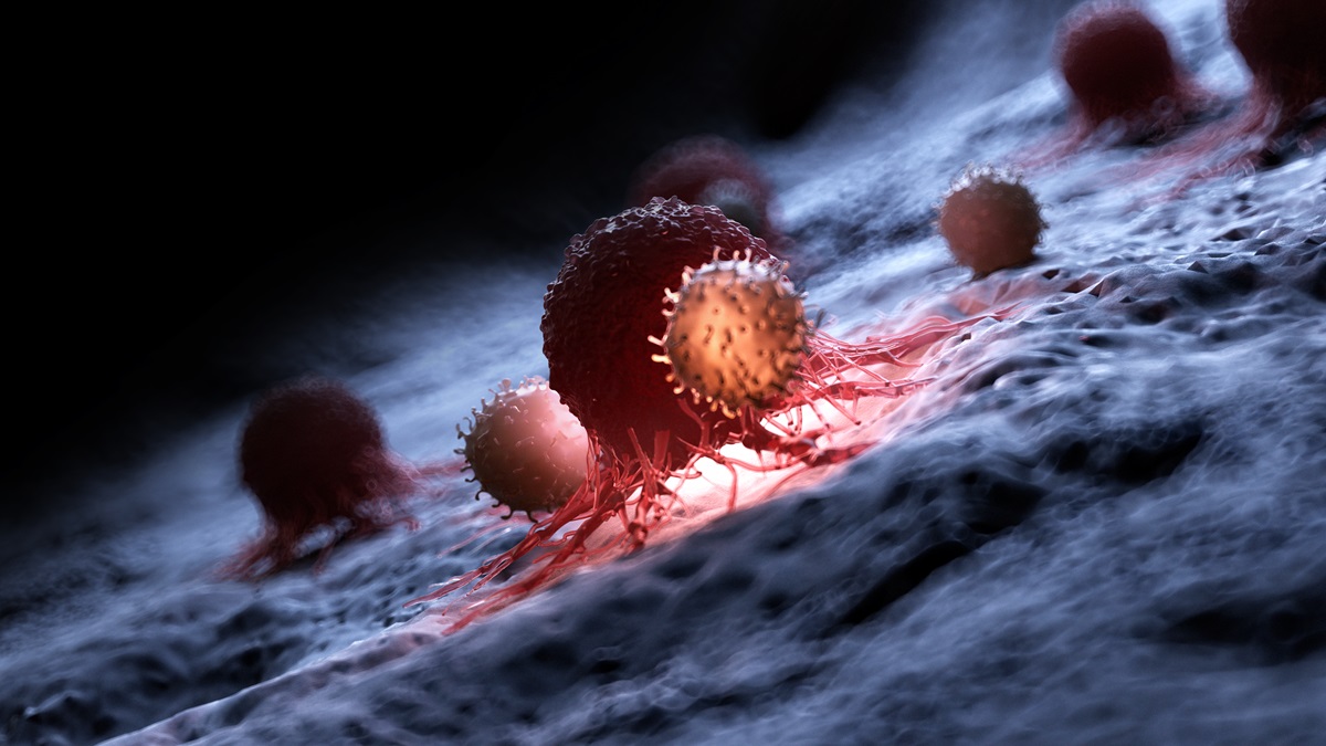 NK Cells Therapy เพชฌฆาตจัดการมะเร็ง