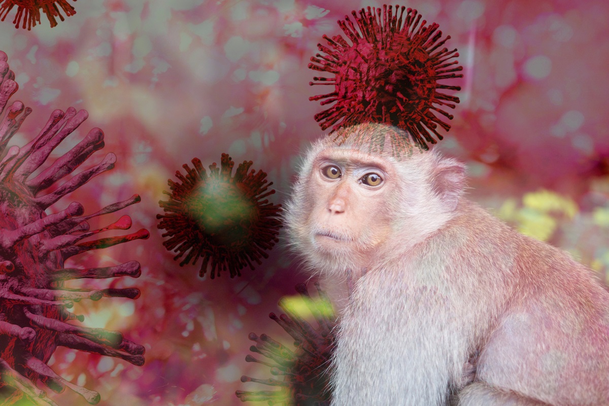 อย่ารอให้ผื่นขึ้น ถึงรู้จักฝีดาษวานร